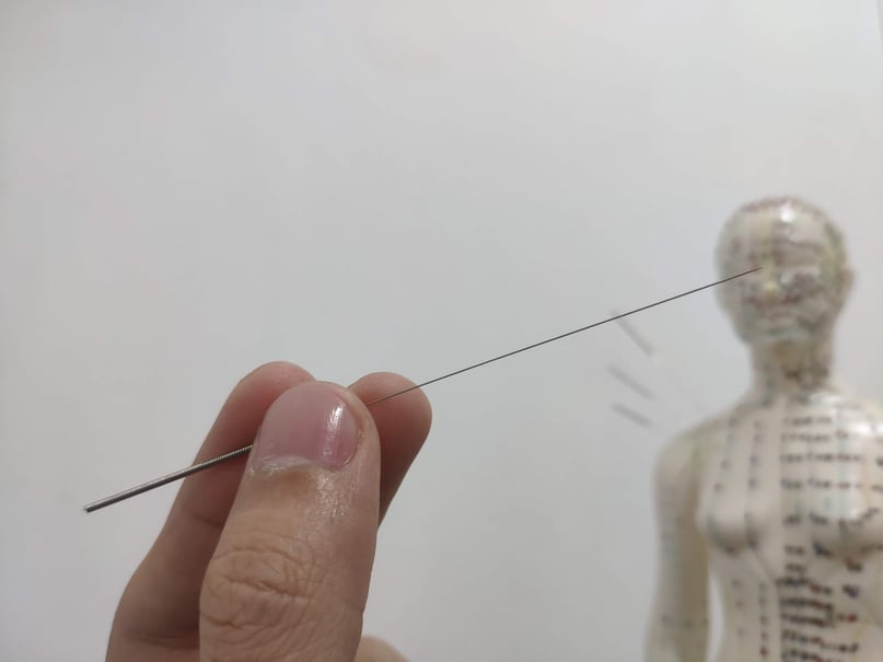 Person's Hand Holding an Acupuncture Needle